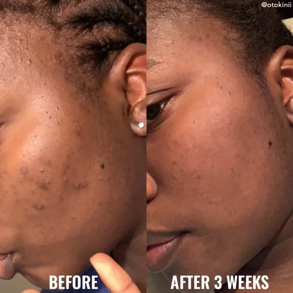 Good Molecules Discoloration Correcting Serum 30ml - Image 5