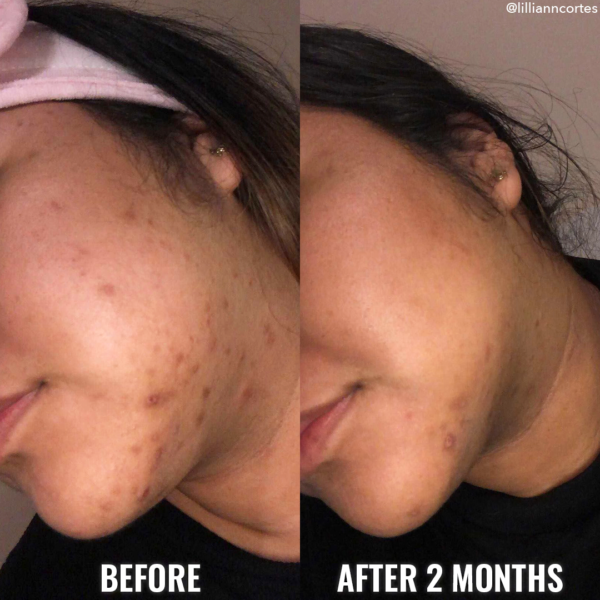 Good Molecules Discoloration Correcting Serum 30ml - Image 4