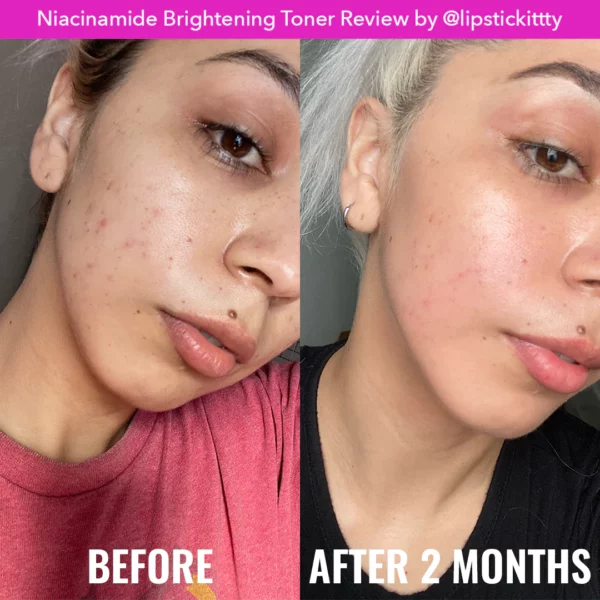 Good Molecules Niacinamide Brightening Toner 120ml - Image 3