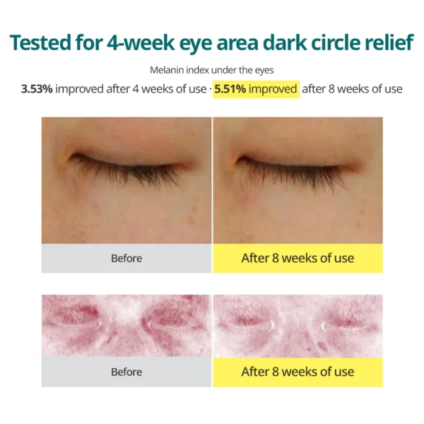 Goodal Green Tangerine Vita C Dark Circle Eye Cream 30ml - Image 3